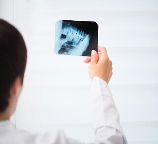 jaw surgery