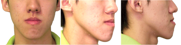 long_face.png