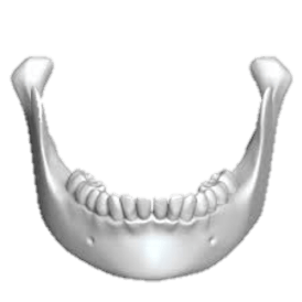 Jaw Reduction & Contouring Surgery