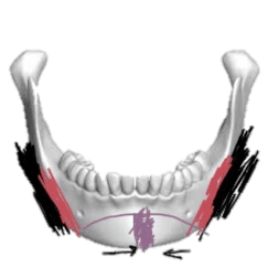 mandible_4.png