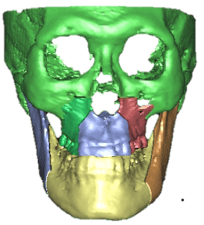 underbite.png